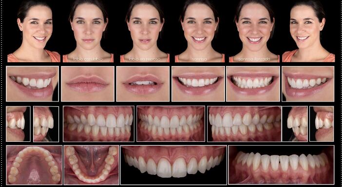 Full-case photographic record — portrait, lip dynamics, intraoral and occlusal views from a single patient case